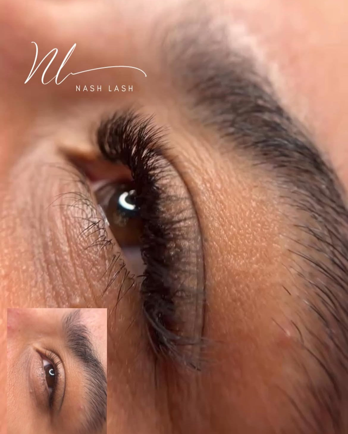 Soft volumen (W 6D)